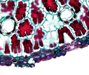 Illustrated cross-section of healthy versus compromised gut lining showing tight junction breakdown and intestinal permeability