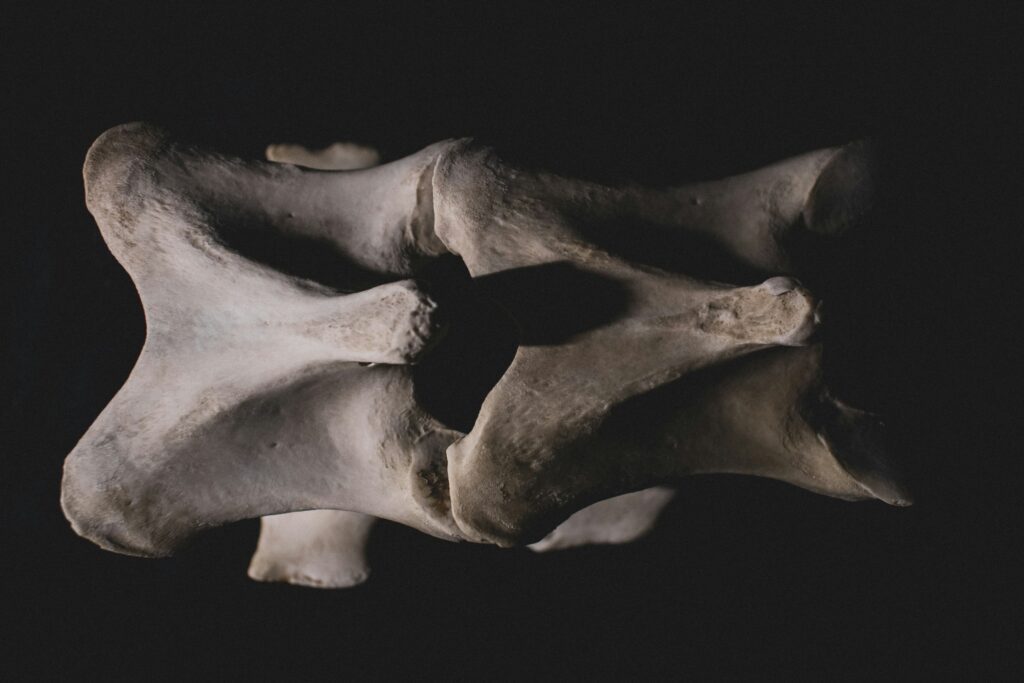 Two vertebrae illustrating bone metabolism at the endplate