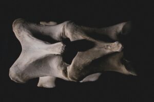Two vertebrae illustrating bone metabolism at the endplate